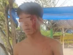 Kasus Penganiayaan Anak Di Labura, Tiga Bulan Bergulir Tersangka Tak Ditahan, Penyidik Bungkam